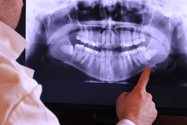 Best Emergency Treatment for Dental Infections or Abscesses in Cleveland, OH
