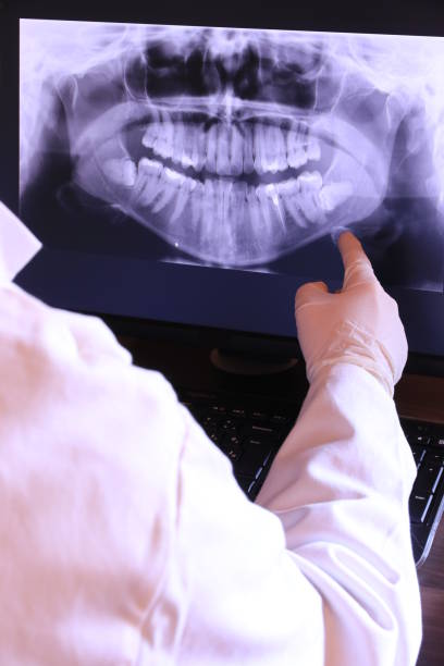 Best Emergency Gum Treatment in Cleveland, OH