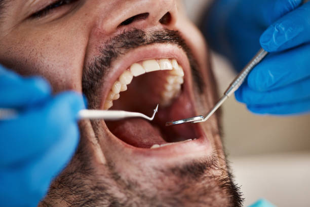 Best Emergency Treatment for Dental Infections or Abscesses in Cleveland, OH